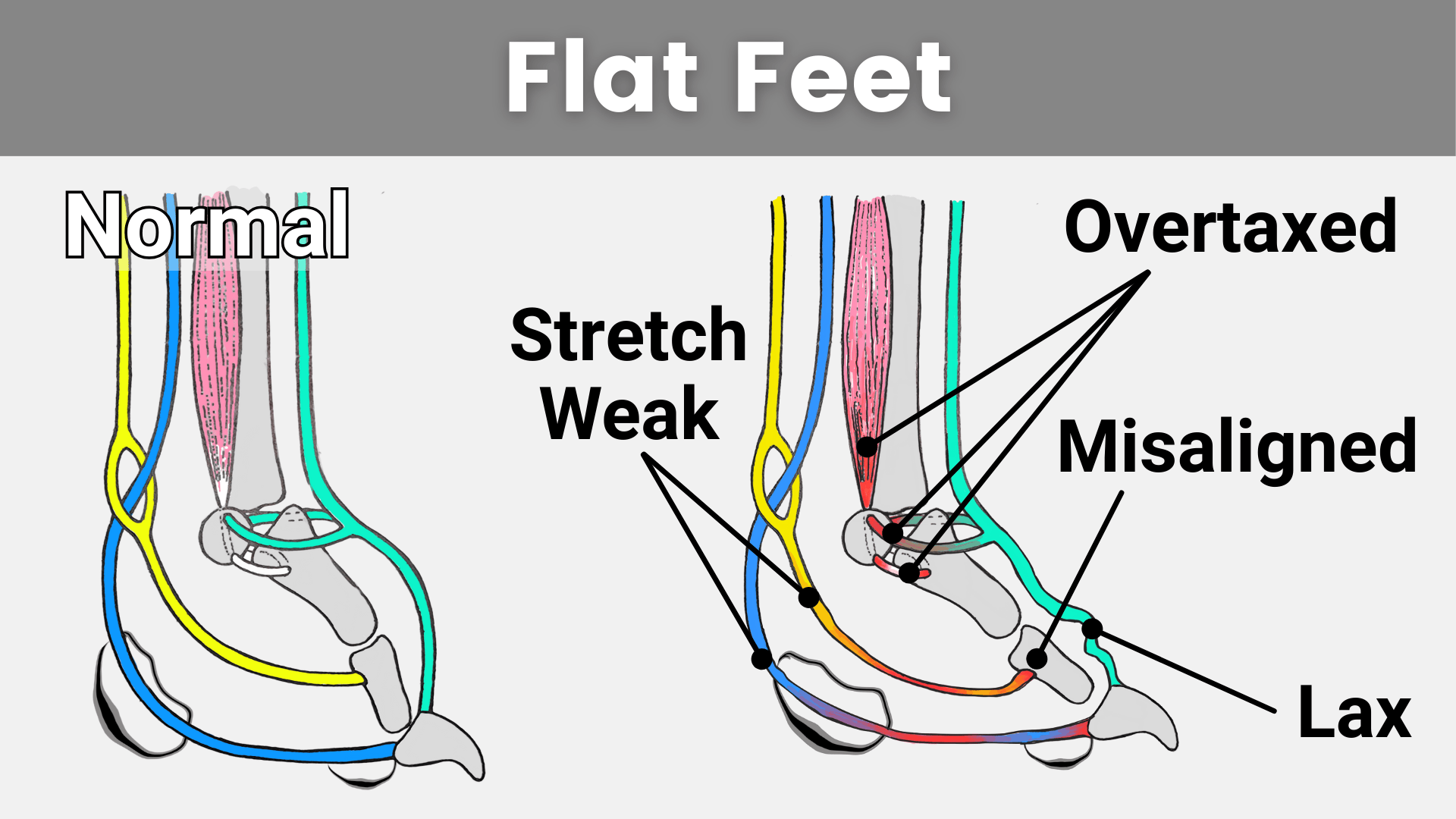Anatomy of Flat Feet in canines