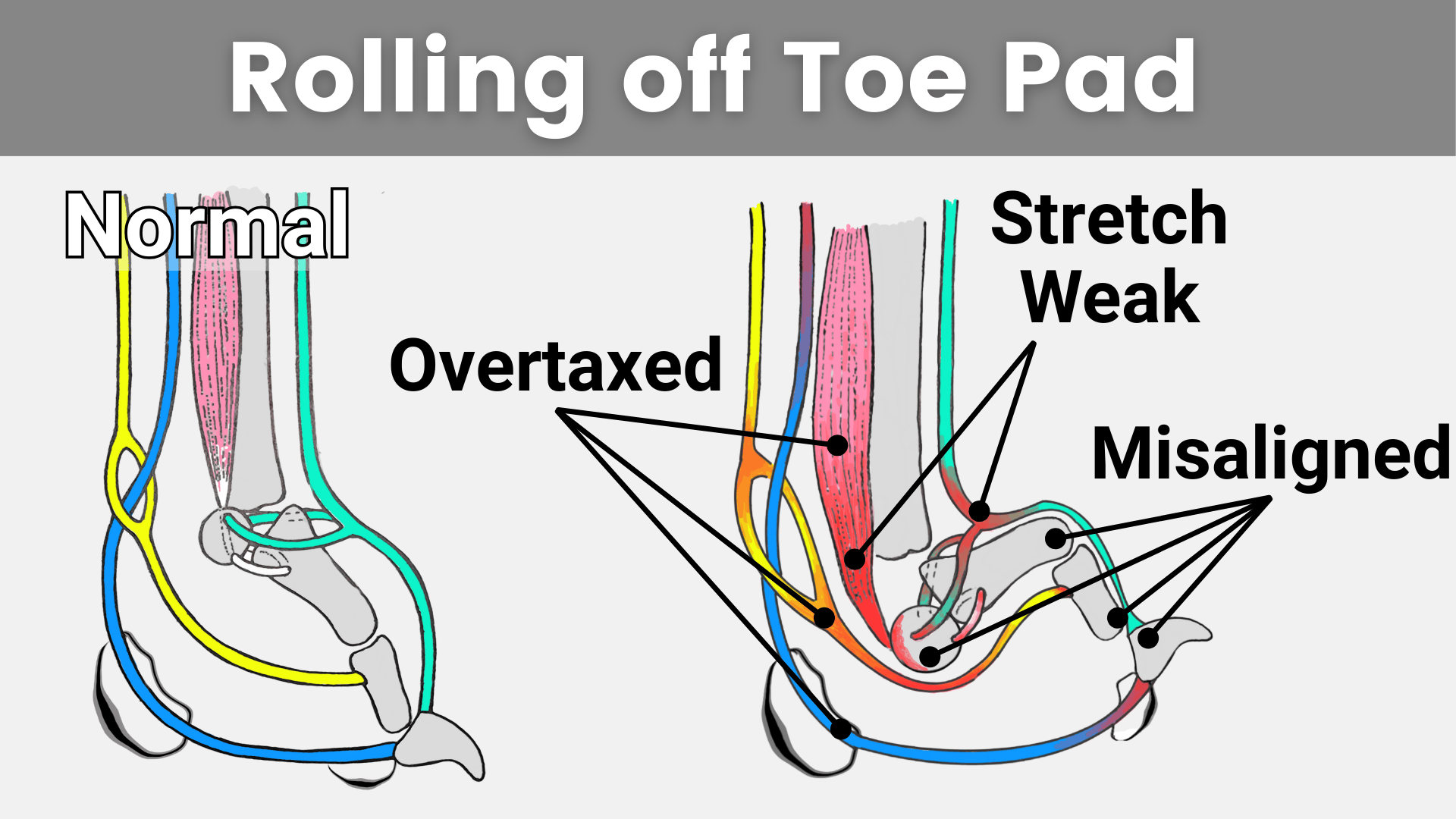 Anatomy graphic comparing normal canine foot alignment to Rolling off the Toe Pads postural deviation.