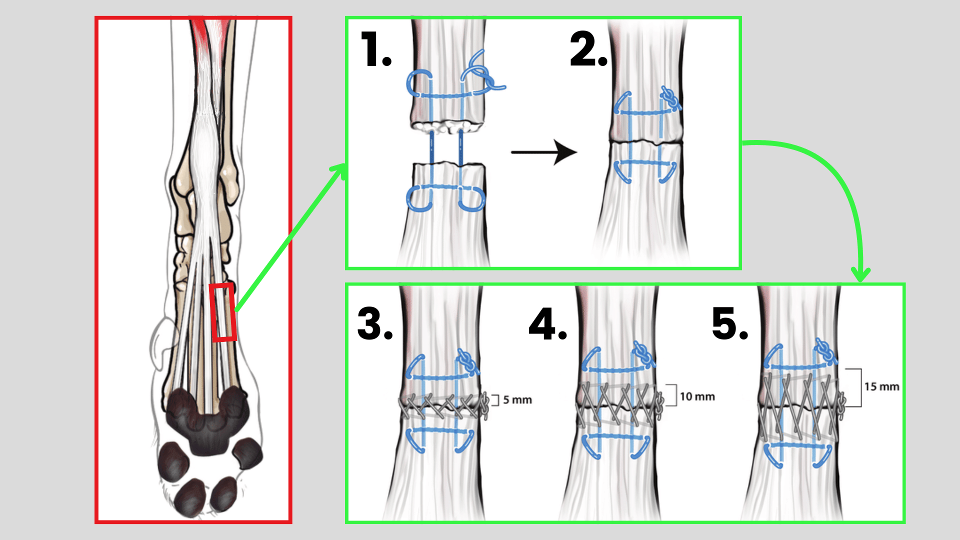 Diagram showing digital flexor tendon repair in the canine foot.