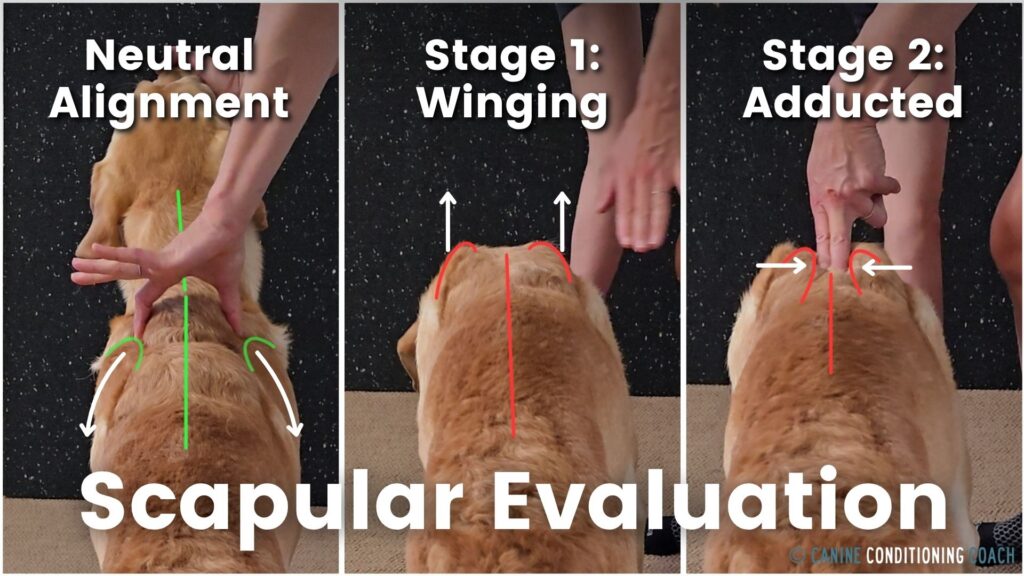 Side-by-side comparison of neutral scapular alignment, Scapular Winging, and Scapular Adduction.